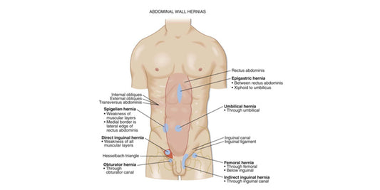 Abdominal wall and groin problems