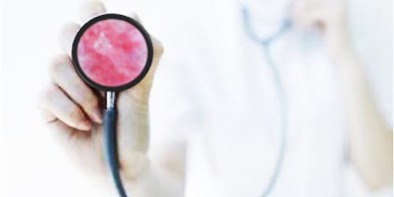 Basic principles of applying dermoscopy in general dermatology