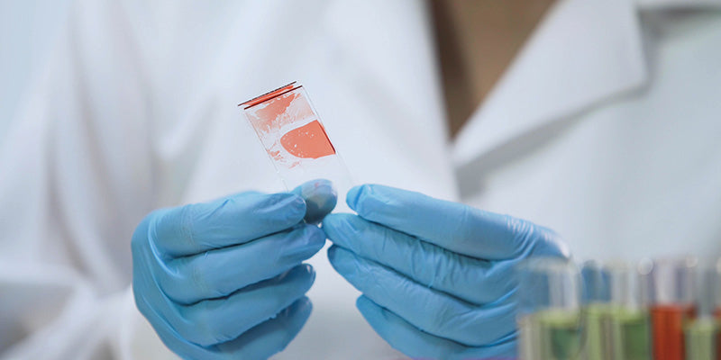 Hepatitis A, B and C