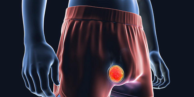 Testicular Cancer and Male Breast Cancer