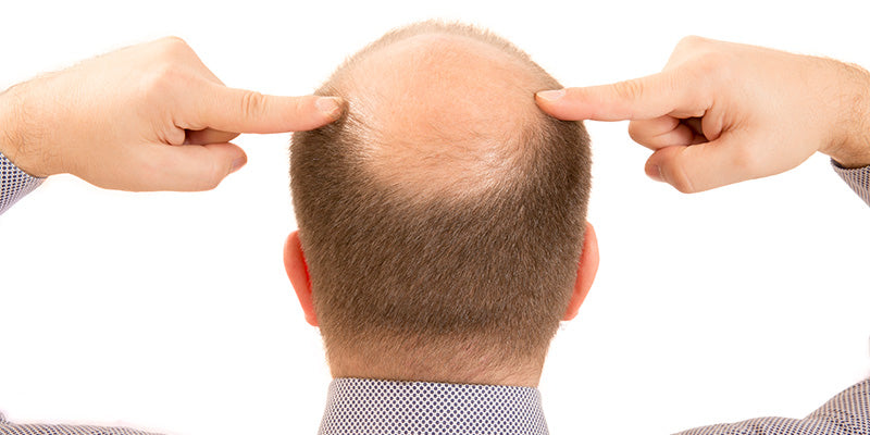 Male hair loss and genital inflammatory dermatoses