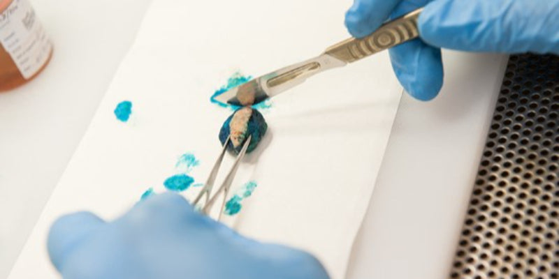 Specimen processing: Does the type of biopsy make a difference? Correlation cases