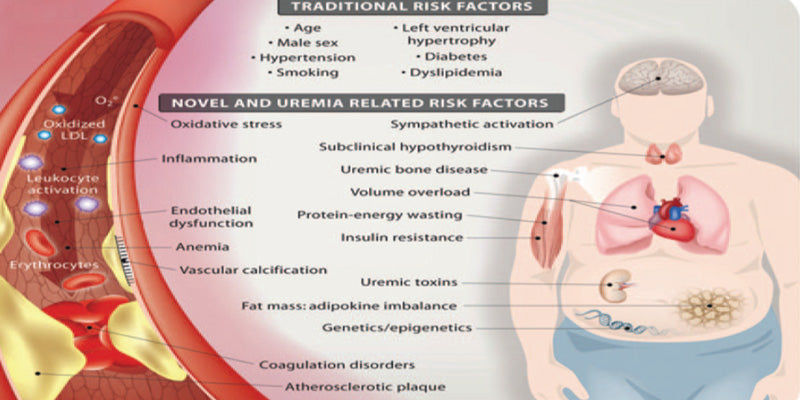 Nutrition in chronic kidney disease