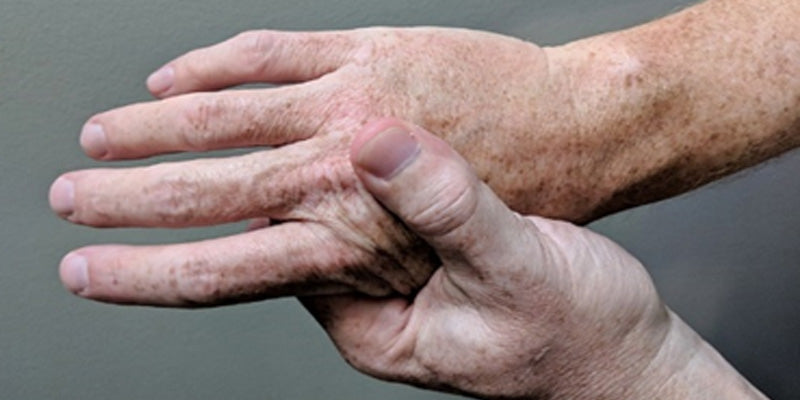 Inflammatory arthritis