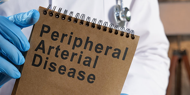 Peripheral arterial disease in men