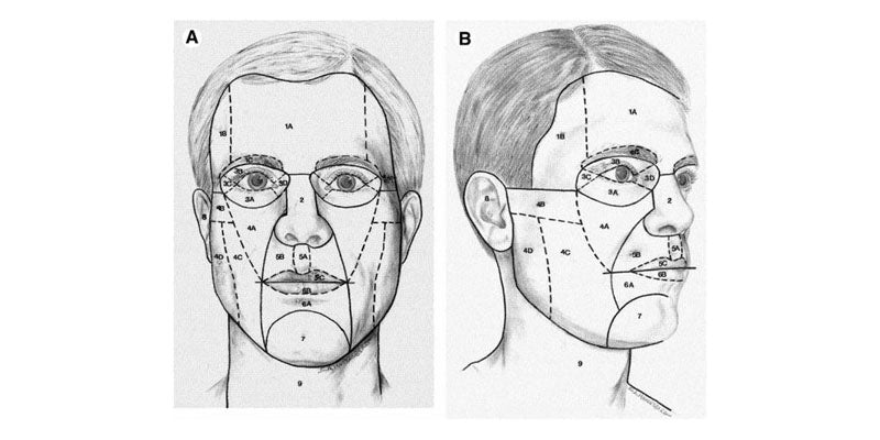 Tips and Tricks revisited for Skin Cancer Surgery