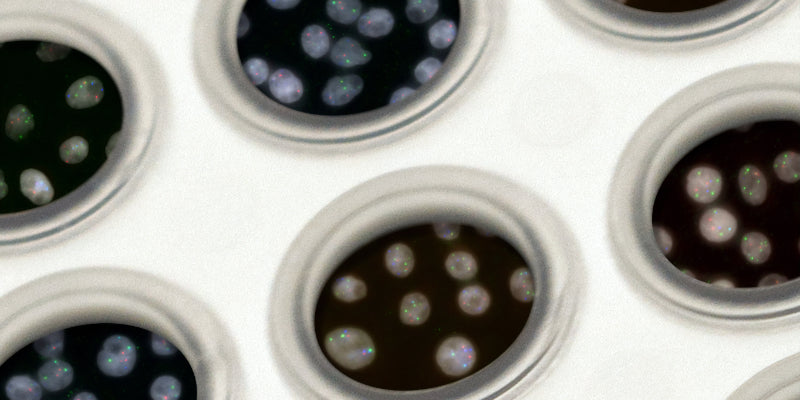 Premature ovarian insufficiency Outcome Improvement Activity