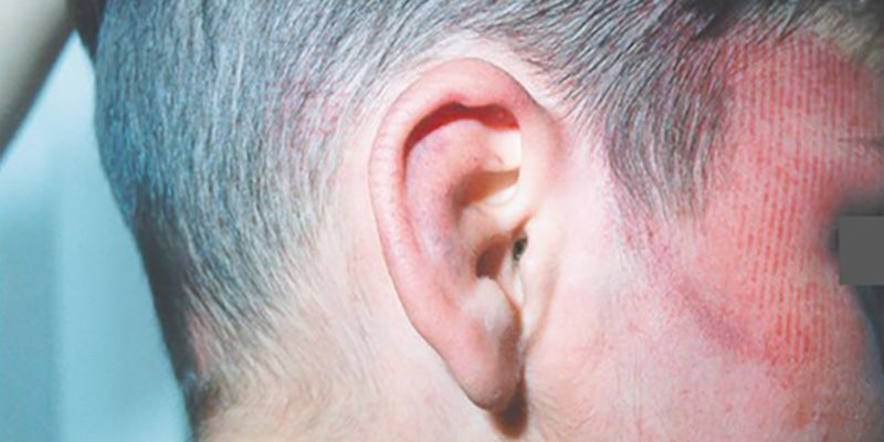 Child physical abuse and neglect