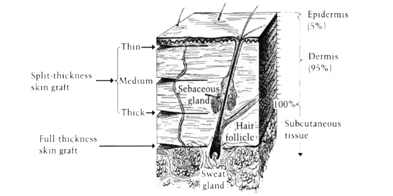 Skin Grafting – Healthcert Education
