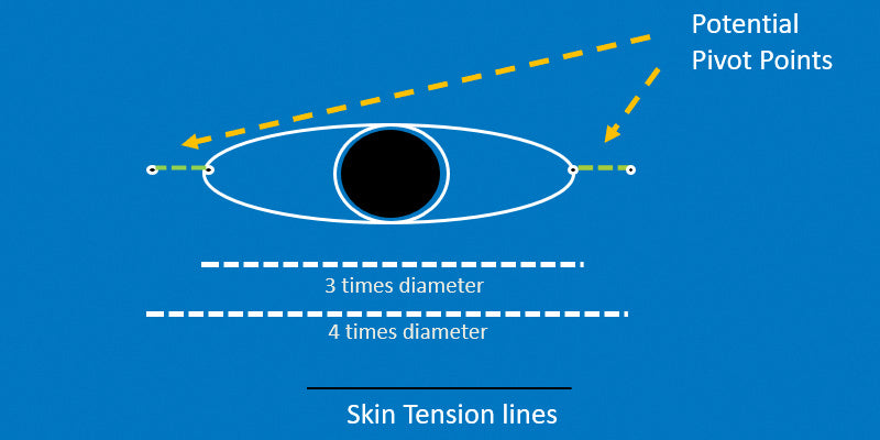 Pivotal Flaps