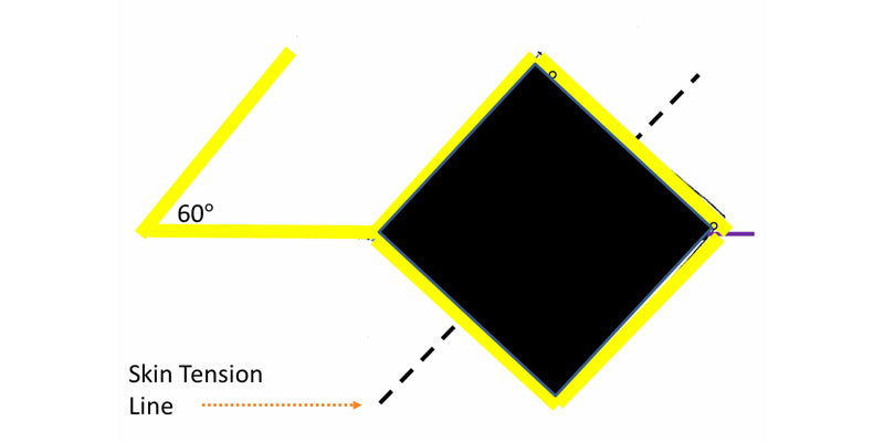 Rhomboid Flaps 1