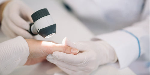 Acral Lesions Outcome Improvement Activity