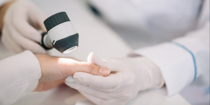 Dermoscopy for acral lesions