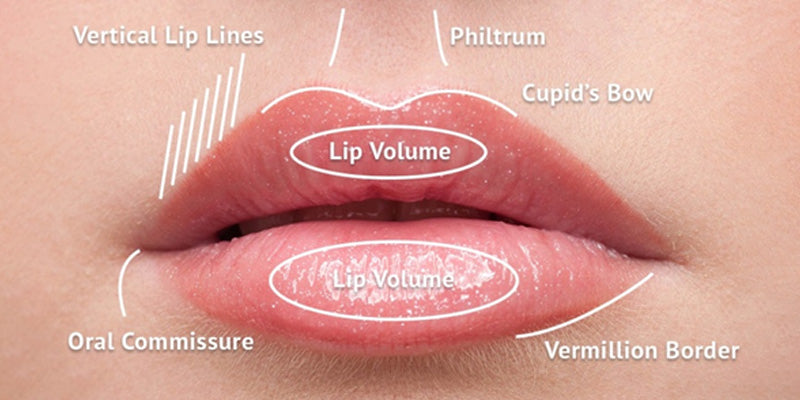 Introduction to dermal filler techniques