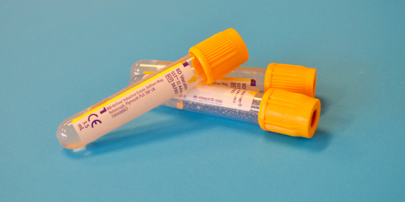 Sexually Transmitted Infections (STI’s) Outcome Improvement Activity